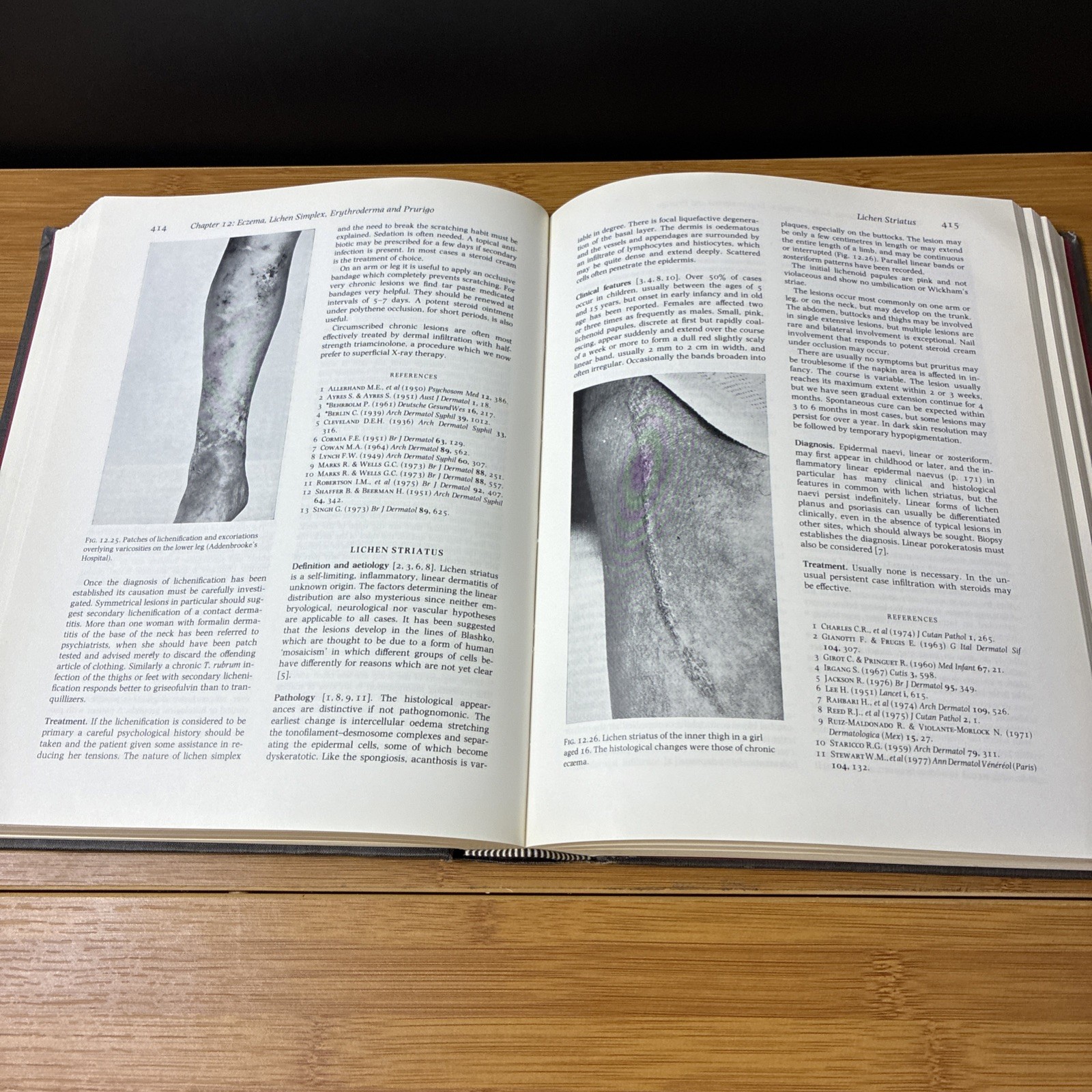 Textbook of Dermatology Vol 1 Fourth Edition (Hardcover, 1986) Blackwell Vintage