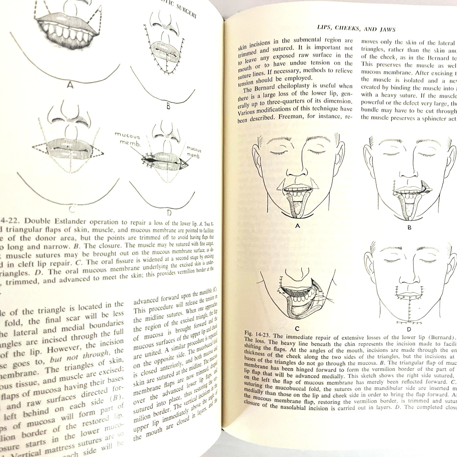 The Lung Clinical Physiology & Pulmonary Function Tests Book Softcover 1968
