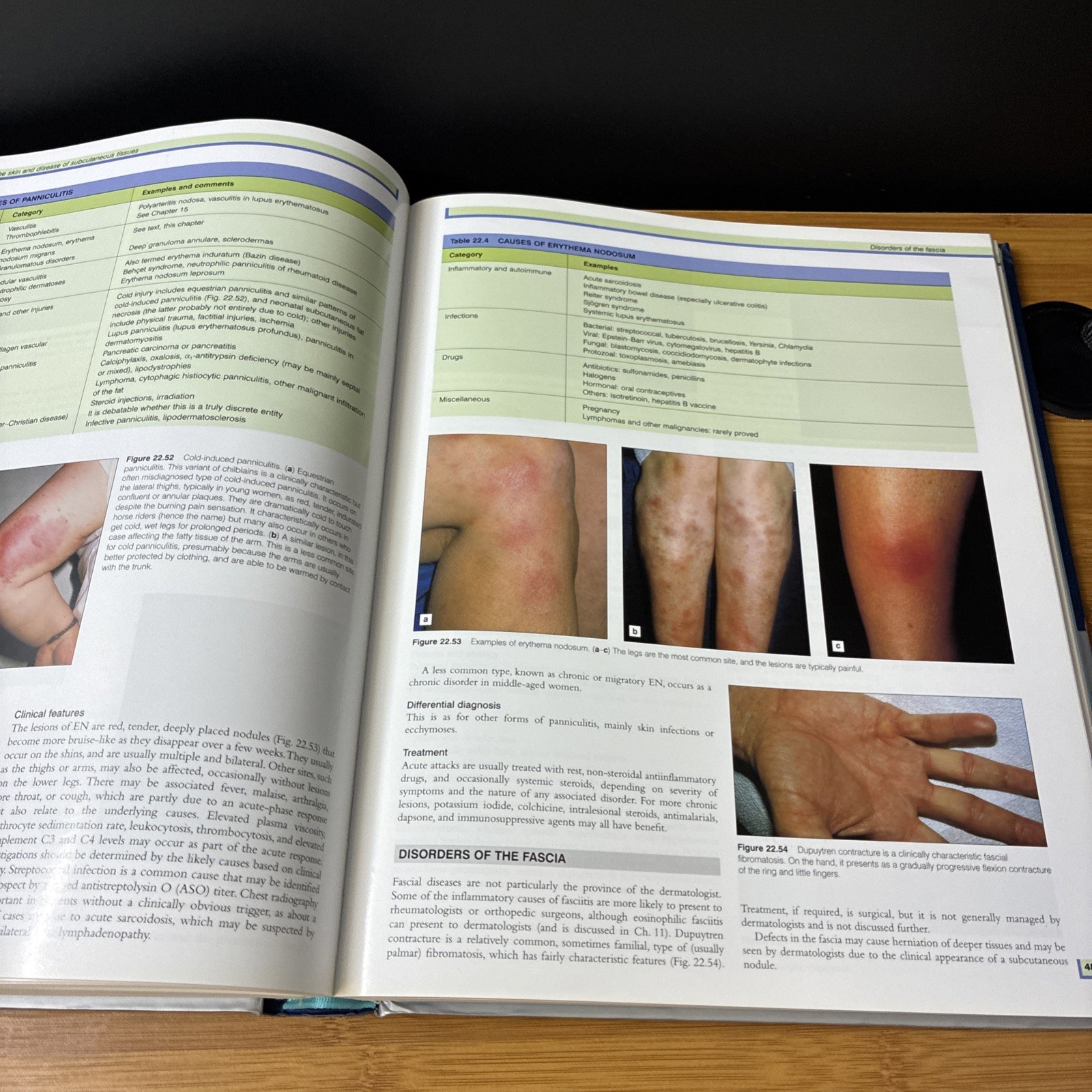 Diseases of the Skin Color Atlas & Text Second Edition Gary White Neil Cox W/ CD