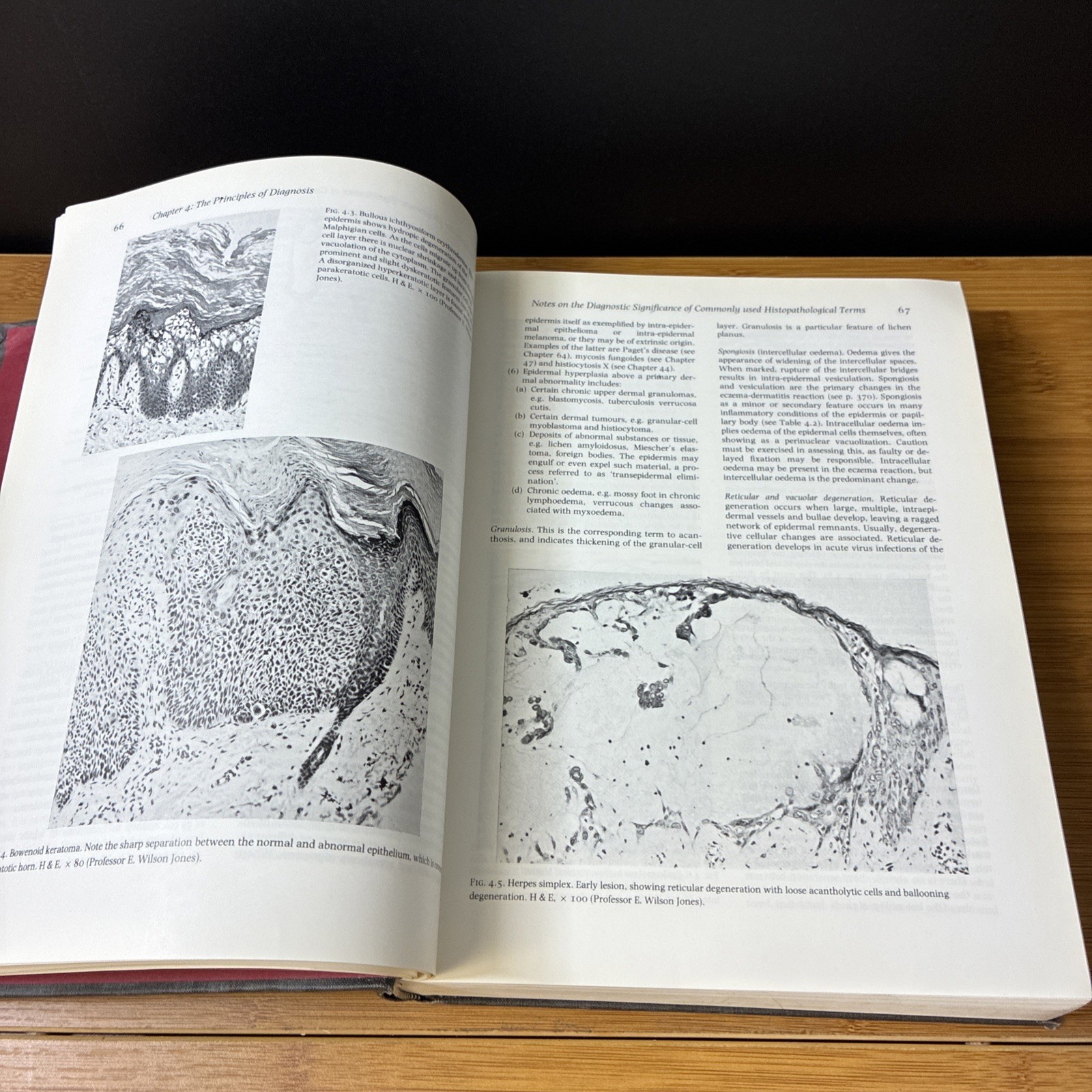 Textbook of Dermatology Vol 1 Fourth Edition (Hardcover, 1986) Blackwell Vintage